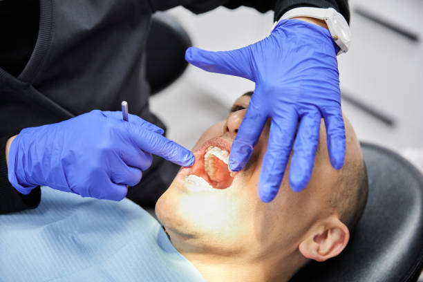 Best Emergency Tooth Extraction in Lake Junaluska, NC
